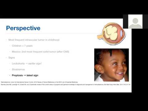 RETINOBLASTOMA - RETINA SESSIONS #4