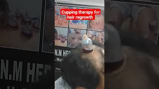 Anm herbal health and skincare clinic Lucknow ? 9235735335 |cupping therapy for hair regrowth ??|