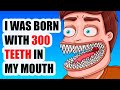 I Was Born With 300 Teeth In My Mouth