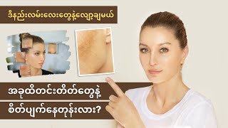မျက်နှာပေါ်က တင်းတိတ်ကို အမြစ်ကအစ ပျောက်ကင်းစေတဲ့ နည်းလမ်း | အလှအပရေးရာ