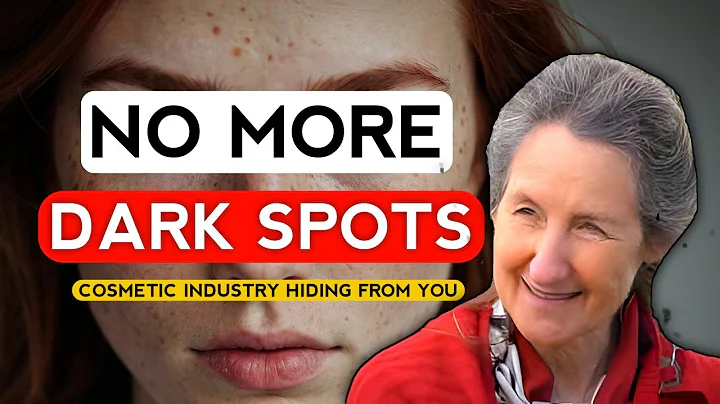 Dr Barbara O Neill's 7 DAY Challenge to Erase Age Spots FOREVER!