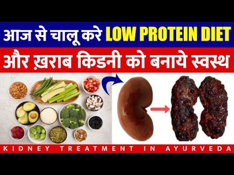 Low Protein Diet For Kidney Patients | Kidney Rogi Ke Liye Diet Chart | Low  Protein Foods Diet List - Youtube