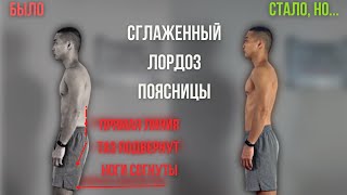 видео: Сглажен поясничный лордоз | Я 4 года занимался не правильно | Комплекс упражнений картинка: Сглажен поясничный лордоз | Я 4 года занимался не правильно | Комплекс упражнений