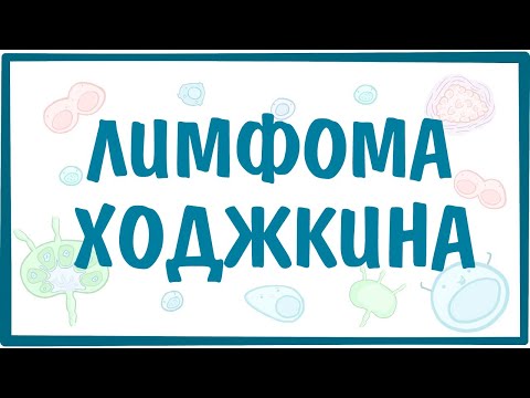 Лимфома Ходжкина (Лимфогранулематоз) — причины, симптомы, патогенез, диагностика, лечение