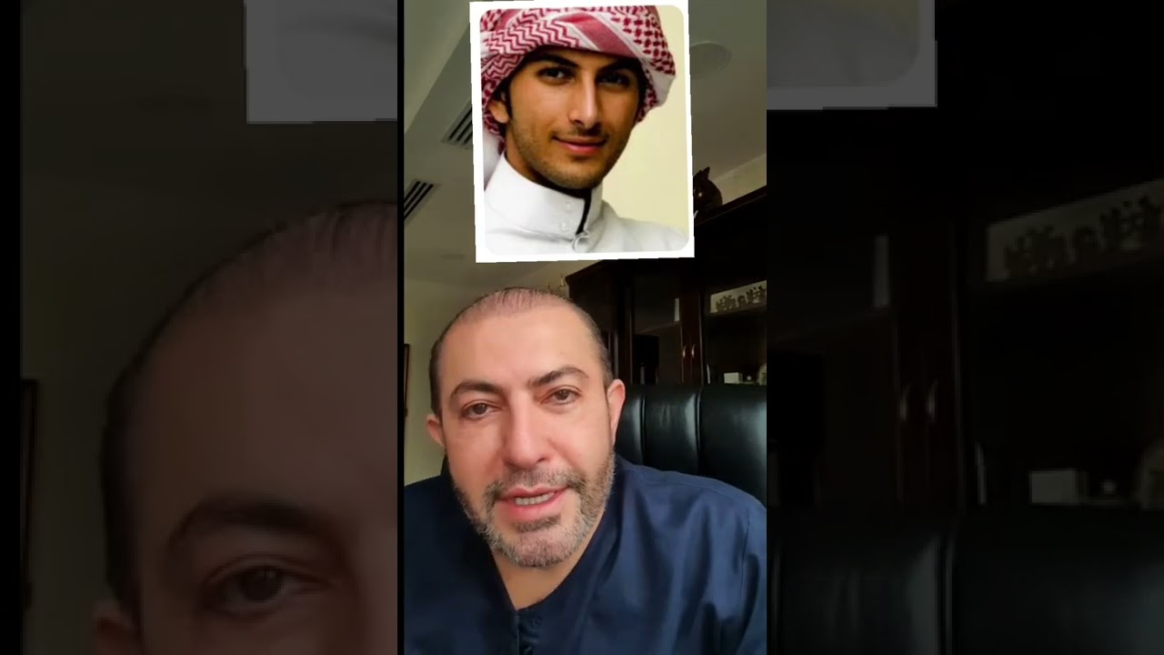 الأنف العربي