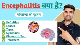 Encephalitis in Hindi | Causes, Types, Symptoms And Treatment of Encephalitis