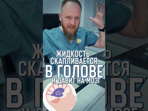 Гидроцефалия головного мозга в простонародье водянка
