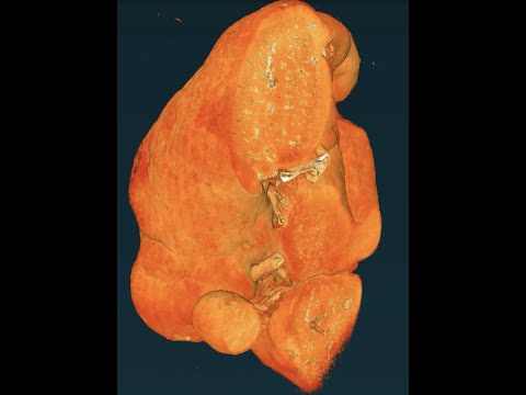 Human Organ Atlas:
