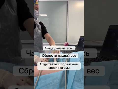 #флебологмосква #варикоз_как_избавиться #лечениеварикоза #флеболог #шортс #полезности #допосле