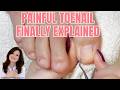 She’s a Nurse… and This Toenail Has Been Hurting Her for Years