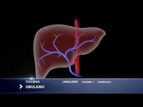 Video: Jinsi ya Kutibu Cholangitis: Hatua 11 (na Picha)