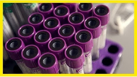 Fda defends plan to regulate lab-developed tests