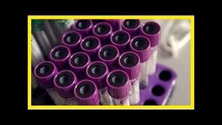 Fda defends plan to regulate lab-developed tests