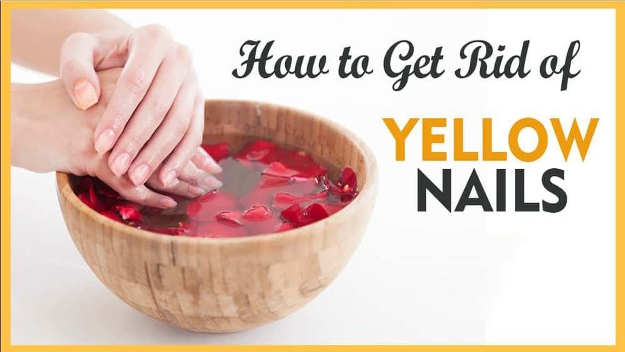 how-to-get-rid-of-yellow-nails-naturally-at-home-home-remedies-for