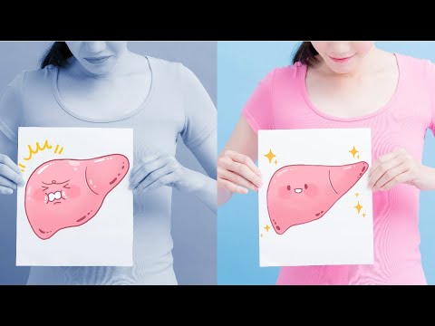 The Non Alcoholic Fatty Liver Disease Solution By Julissa Clay - YouTube