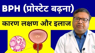 🌟What is BPH (Benign Prostatic Hyperplasia) in Hindi 🩸Prostate Enlargement Symptoms and Treatment