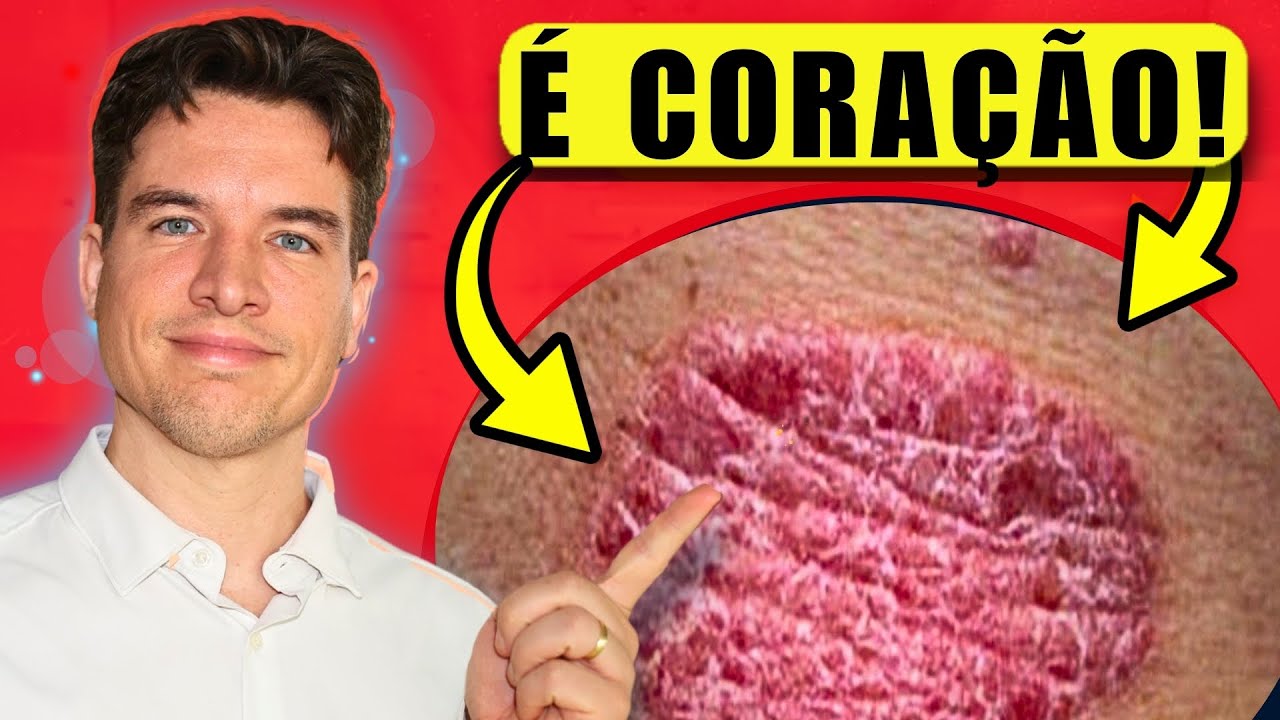 12 Sinais na Pele que Revelam Problemas no Coração - YouTube