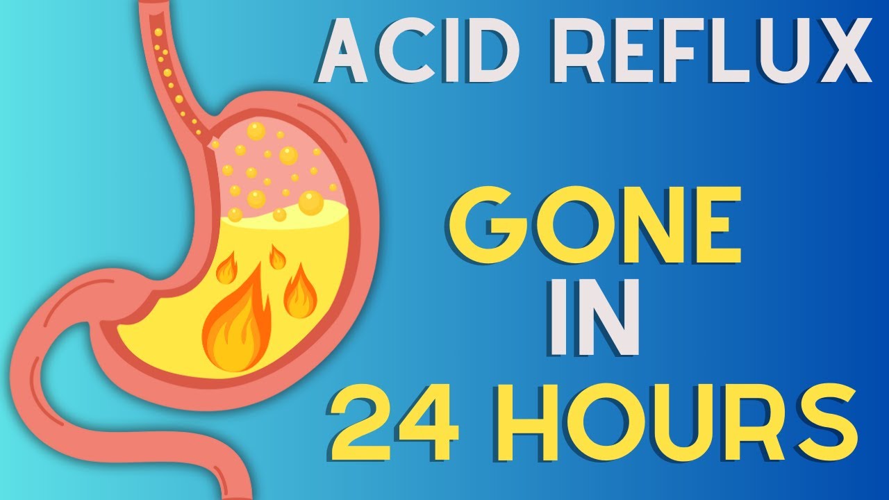 Top 10 Foods That Will Fight ACID REFLUX & HEARTBURN