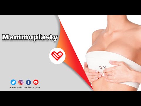 Video: Möjligheterna Med Mammoplasty