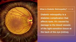 Diabetic Retinopathy Treatment in Delhi | Diabetic Retinopathy and its Symptoms - Dr Charu Mithal