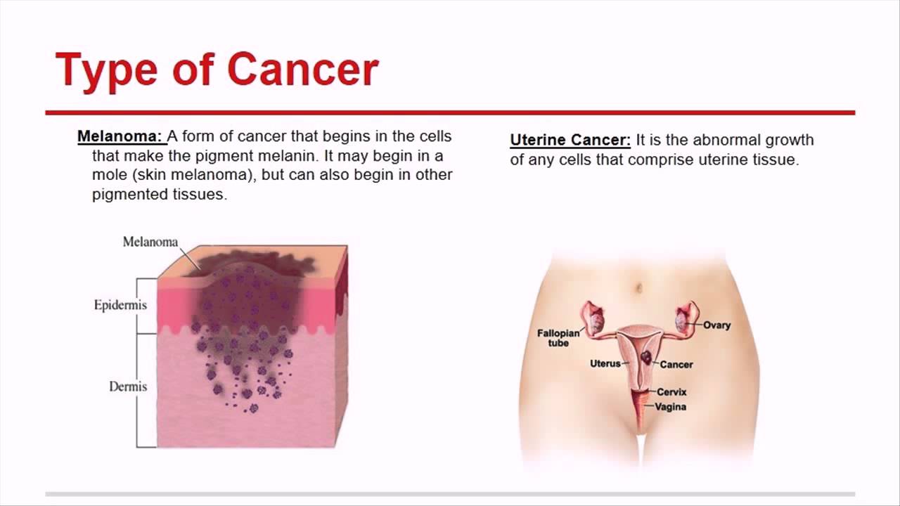 Cuántos tipos de cáncer hay