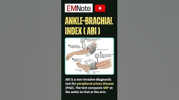 Ankle Brachial Index (ABI) #doctor #nursing #medical