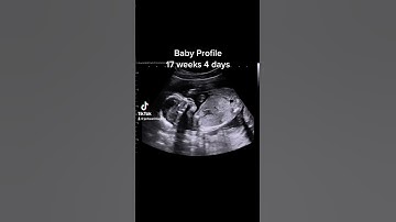 Baby Profile 17 weeks 4 days #jerbearimaging #fyp #17weeks4days #athomeultrasound #pregnantlife