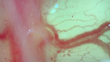 E3.0 chicken embryo - RBCs in vitelline veins