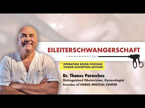 Video: So Identifizieren Sie Eine Eileiterschwangerschaft