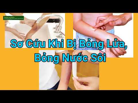 Video Sơ Cứu Khi Bị Bỏng Lửa, Bỏng Nước Sôi - youtube