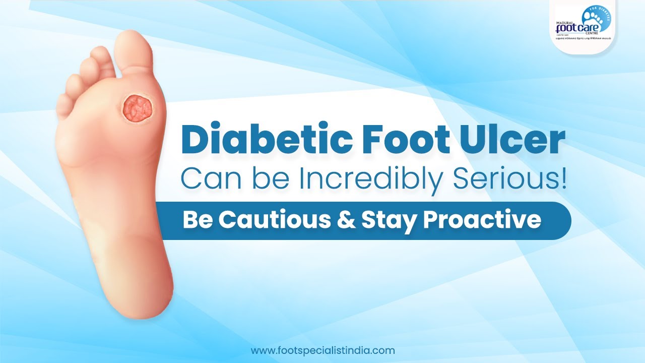 What are the Complications of Diabetic Foot Ulcer? Best Diabetic Foot