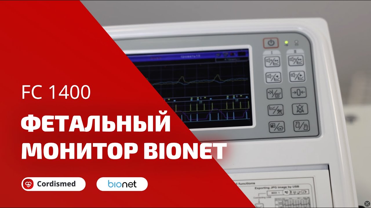 Обзор фетального монитора Bionet FC-1400