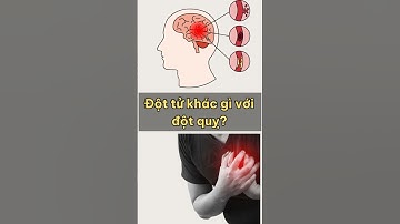 Đột tử khác gì với đột quỵ? #dottu #dotquy #biquyetsuckhoe