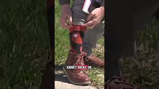 Bret Lemoine shows some ankle on Wisconsin Live Desk