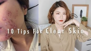 十个让皮肤更好的秘诀?如何维持皮肤稳定 | 10 Tips for Clear Skin | Sylvia黄瓜瓜