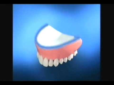 Sea-Bond denture adhesive commercial (1994) 