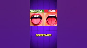 I Bet Only 1% People Will Understand & Get These Quizzes Right !! 🤯 #mindbendingquiz #shorts