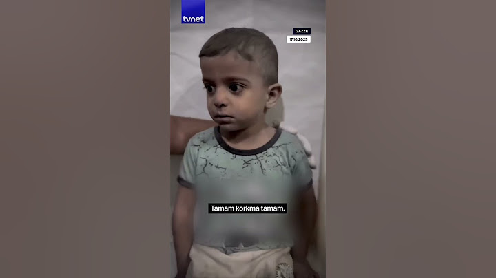 Filistinli çocuğu doktor sakinleştirdi #gazze #gündem #shorts