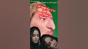 Shortvideo الناز حبیبی دماغ بزرگ تهمینه قبل از عمل 