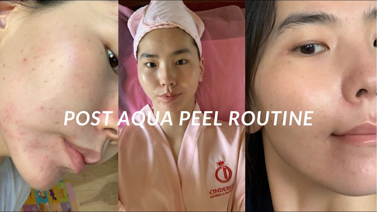 Эмзэг болон эмзэгшсэн арьс арчилгаа