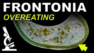 Frontonia Biting Off More Than They Can Chew @ThaiMicrocosmos