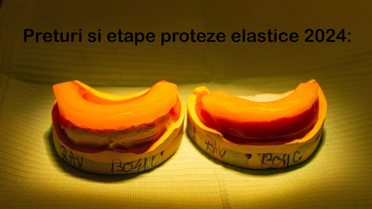 Preturi proteze elastice si etape in 2024  (Raspund la intrebarile dvs. )