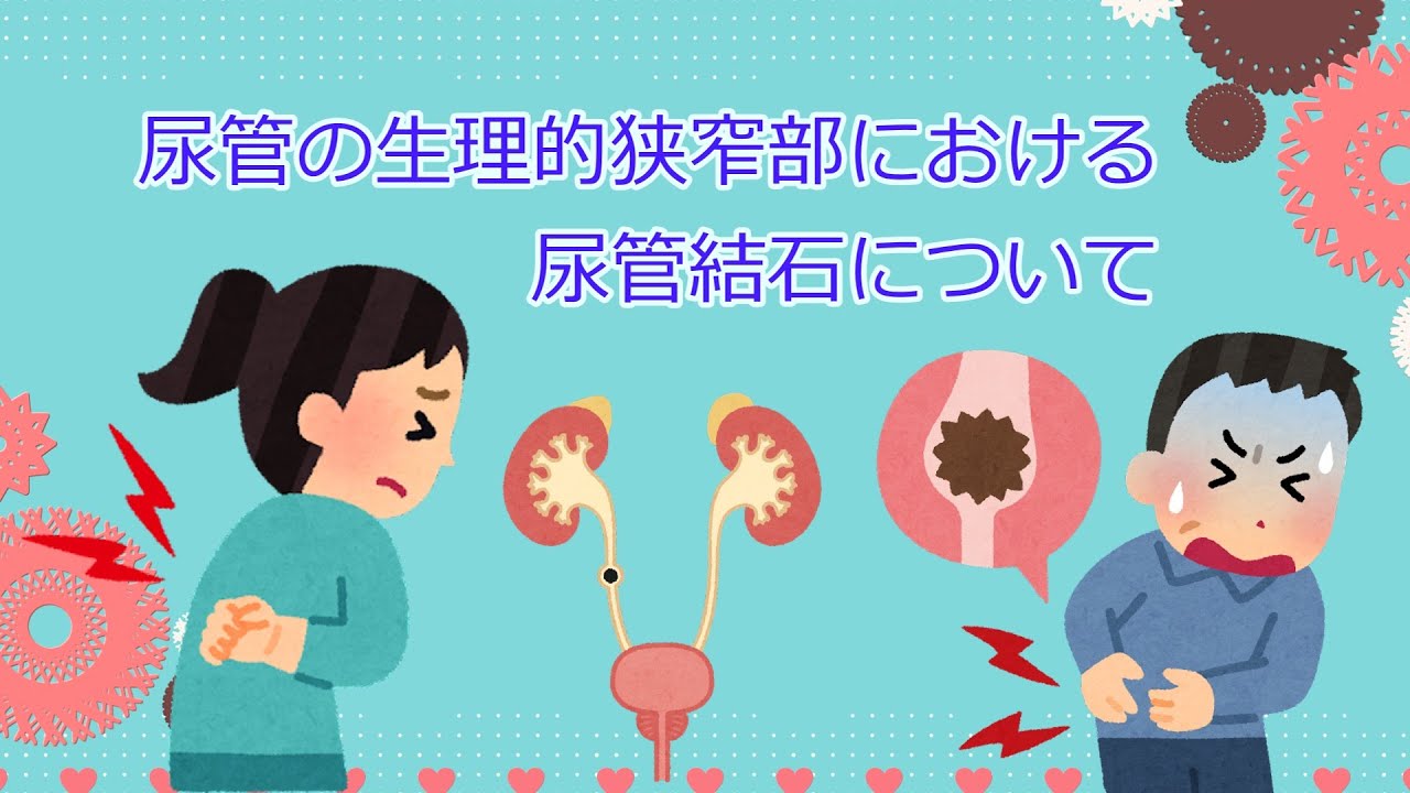 尿管の生理的狭窄部における尿管結石について - YouTube