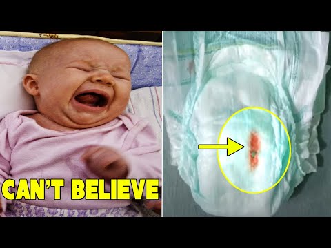Her baby did not stop crying When she changed her diaper, she discovered something terrible. SEE WHA