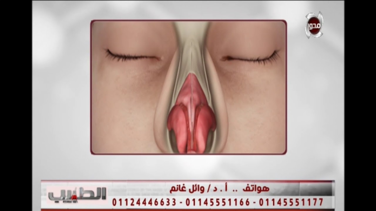 د/ وائل غانم يتحدث عن العيوب والتشوهات الخلقية في الأنف وطرق علاجها  -الطبيب