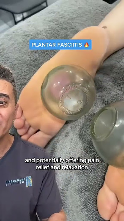 Cupping Therapy for Feet | The Ultimate Plantar Relief Technique?