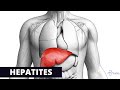 LES DIFFERENTES TYPES D´HEPATITE