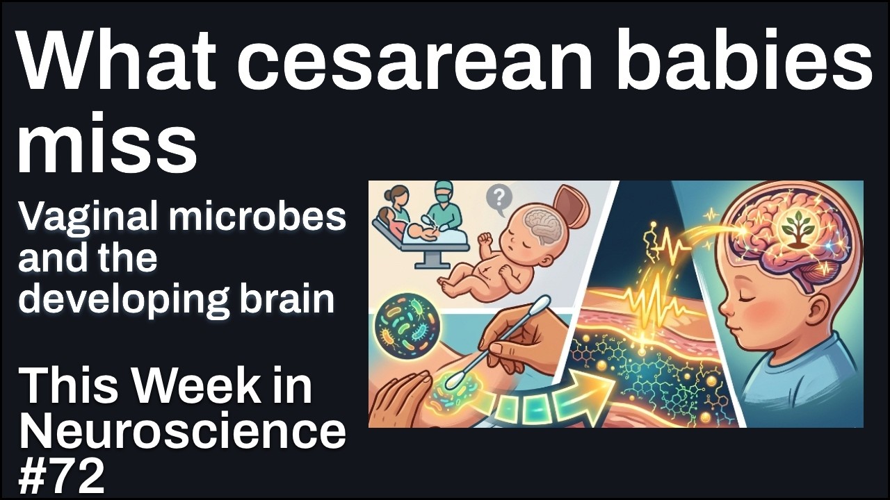 TWiN 72: What cesarean babies miss - YouTube