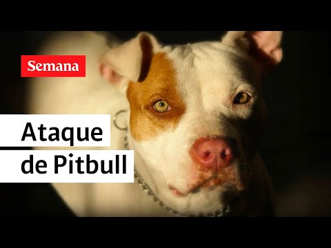 Ataque de perro Pit Bull ¿Qué hacer en ese caso? |Videos Semana