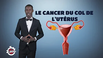 Comment savoir si on est atteint du cancer du col de l'utérus